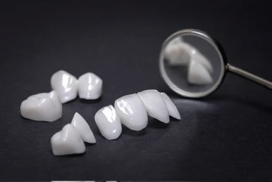 Преимущество зубных коронок E-Max